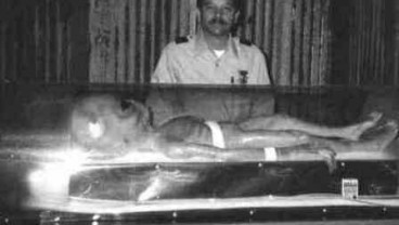Foto Bedah Alien Tahun 1947 Gegerkan Dunia