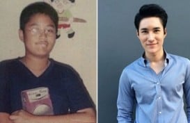 Pemuda Jelek Ini Sekarang Mirip Artis Usai Operasi Plastik