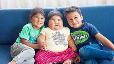 Idap Penyakit Langka, Bayi 10 Bulan Ini Terlihat Seperti Anak 5 Tahun