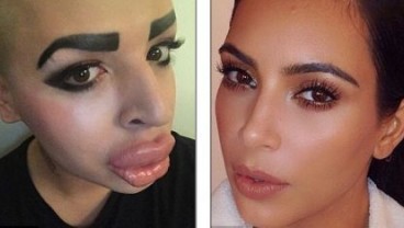 Pria Ini Operasi Wajah Demi Mirip Kim Kardashian