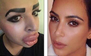 Pria Ini Operasi Wajah Demi Mirip Kim Kardashian