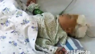 Astaga, Sumpit 6 Cm Masuk Ke Otak Bayi