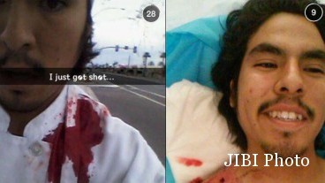 Luka Parah Tertembak, Pria Ini Malah Selfie