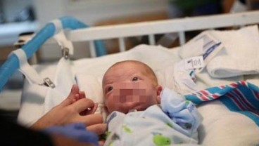 Orang Tua Ini Terkejut Saat Sang Bayi Lahir Tanpa Hidung