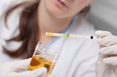 Urine Anda Berbau Tajam? Waspadai 7 Penyebab Berikut Ini