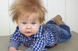 Bayi Ini Memiliki Rambut Unik Sejak dalam Kandungan