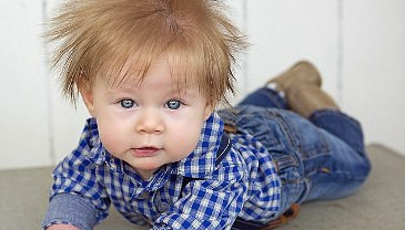 Bayi Ini Memiliki Rambut Unik Sejak dalam Kandungan