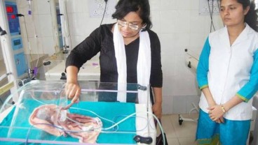 Kelahiran Bayi Berkaki 4 dan Berlengan 4 Hebohkan Netizen
