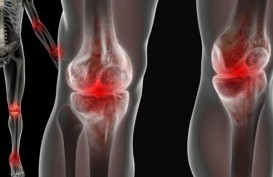 Cegah Osteoarthritis dengan Gaya Hidup Sehat