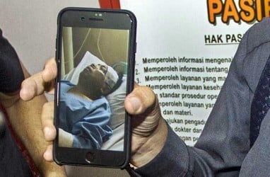 SETYA NOVANTO KECELAKAAN: RS Medika Permata Hijau Akhirnya Kooperatif