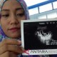 Kehamilan Perempuan Ini Hilang Misterius
