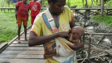 Penderita Gizi Buruk di Asmat Papua Capai 15.000 Orang