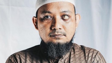 Kasus Novel Baswedan Belum Terungkap Sampai Setahun Memalukan Bangsa