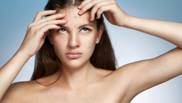 Tak Semua Kulit Berjerawat Bisa Diatasi dengan ‘Facial’