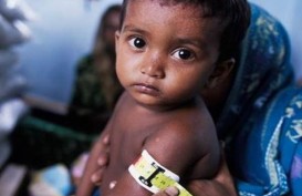 Malnutrisi Pada Anak, Begini Cara Mencegahnya