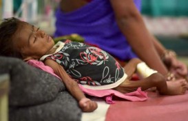 85.000 Anak Mati Kelaparan Akibat Konflik Yaman
