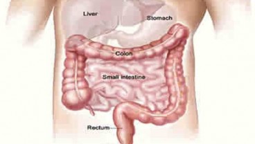 Penyebab dan Cara Mengatasi Sembelit