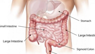 KESEHATAN DIGESTIF : Asa Baru Penderita Kanker Kolon