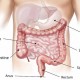 KESEHATAN DIGESTIF : Asa Baru Penderita Kanker Kolon