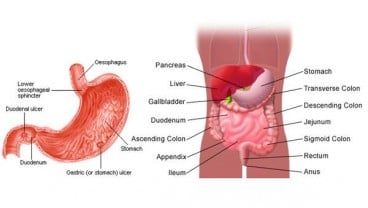 OPERASI BARIATRIK : Perkecil Lambung Atasi Obesitas