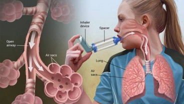 12 Strategi Agar Polusi Udara Tak Mengancam Kesehatan