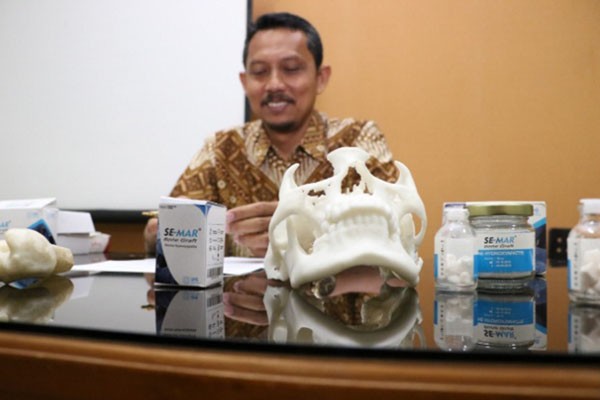 Dr Joko Triyono dengan produk penmgisi tulang Bone graft./Istimewa