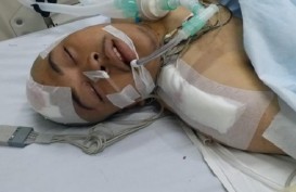 DEMO DI DPR: Faisal Amir Kritis, Alami Perdarahan di Otak dan Patah Tulang