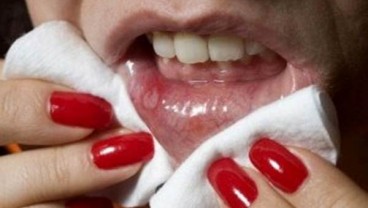 Fakta Herpes, Wanita Lebih Gampang Tertular Dibanding Pria