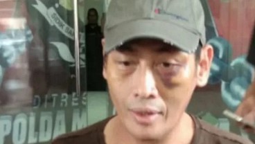 Polisi Tahan 12 Tersangka Penganiaya Relawan Jokowi Ninoy Karundeng