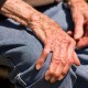 Studi: Parkinson Mungkin Merupakan Penyakit Bawaan Lahir