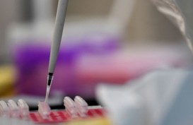 Uji Petik Virus Corona, Kemenkes Periksa Sampel Dua Pasien TBC