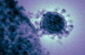 Penularan Virus Corona di Masyarakat Terkonfirmasi di Irlandia