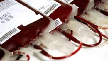 Terapi Plasma Darah Untuk Memperkuat Imunitas Pasien Virus Corona