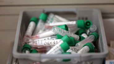 Ini Beda Tes PCR dengan Rapid Test Virus Corona