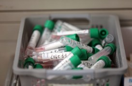 Ini Beda Tes PCR dengan Rapid Test Virus Corona