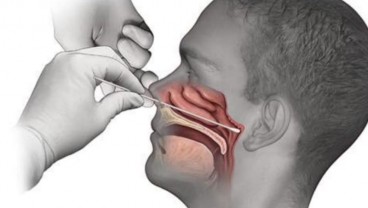 Begini Cara Test Swab Hidung Cek Virus Corona 