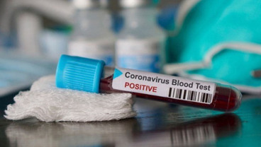 Rapid Test COVID-19 Sentuh 2.747 Warga di Depok, 67 Terinfeksi