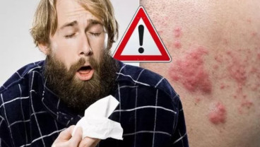 Bintik Merah Disertai Gatal Jadi Gejala Baru Virus Corona