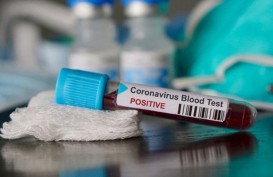 Peneliti AS Kumpulkan 10.000 Sampel Darah untuk Studi Penyebaran Virus Corona