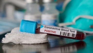 Update Covid-19 Global: Hotspot Virus Corona Catat Penurunan Kasus