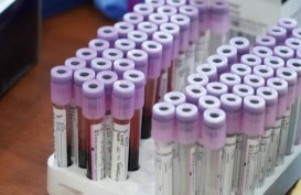 Roche Holding Kembangkan Alat Uji Antibodi Virus Corona