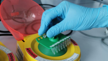 BBPT dan Bio Farma Siap Produksi PCR Mandiri, Tes Covid-19 Diklaim Lebih Valid