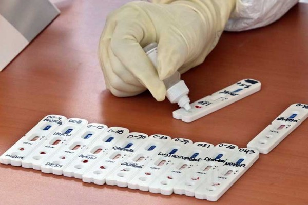 Petugas medis memperlihatkan sampel darah  saat tes cepat (Rapid Test) COVID-19 /Bisnis/Eusebio Chrysnamurti