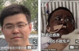 Dokter Wuhan yang Kulitnya Berubah Saat Pengobatan Covid-19 Akhirnya Meninggal