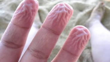 Penyebab Kulit Tangan dan Kaki Menjadi Keriput Setelah Terendam Air