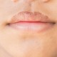 Cek Fakta : Bibir Kering dan Bersisik Jadi Gejala Virus Corona