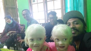 Anak Perempuan Kembar Albino Bikin Heboh Wonigiri