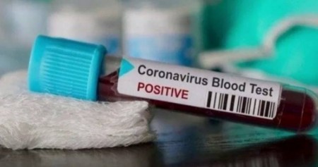 Ilustrasi - Sampel darah yang terindikasi positif Virus Corona./Antara