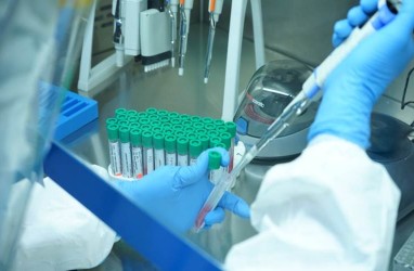 Swab PCR Berteknologi Jerman Ini Ditawarkan Mulai dari Rp800ribuan