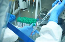 Swab PCR Berteknologi Jerman Ini Ditawarkan Mulai dari Rp800ribuan
